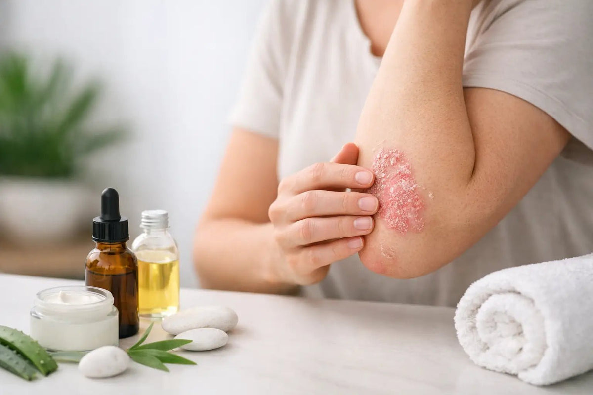 A Practical Guide to Steroid-Free Psoriasis Care - Loma Lux Laboratories