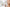 Acne Patches vs Spot Treatments: Which Works? - Loma Lux Laboratories