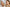 Acne Routine Before and After: What to Expect - Loma Lux Laboratories