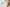 Best Hydrocolloid Acne Patches Explained - Loma Lux Laboratories