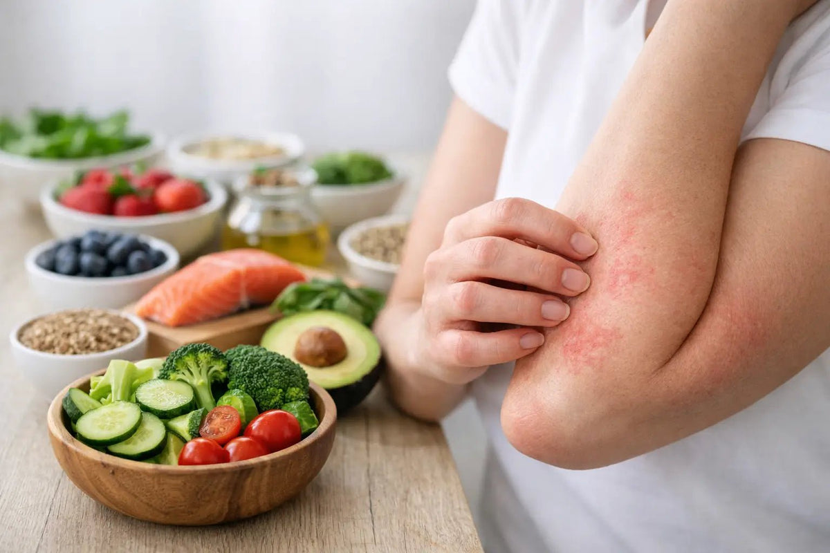 Can Diet Affect Eczema? What to Watch For - Loma Lux Laboratories