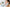 Ice Roller for Acne Swelling: Does It Help? - Loma Lux Laboratories