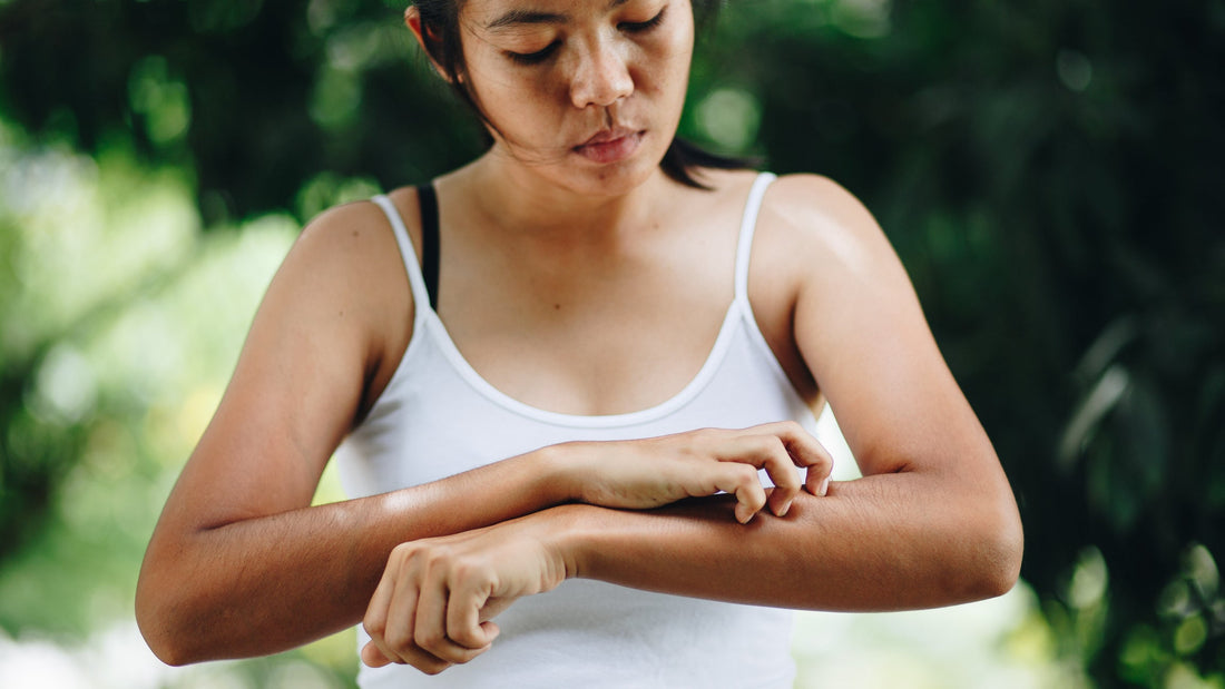 Eczema - Loma Lux Laboratories